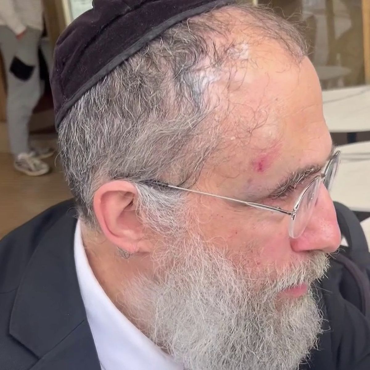 « Un rabbin agressé à Neuilly-sur-Seine : une violence inacceptable qui secoue la communauté juive »